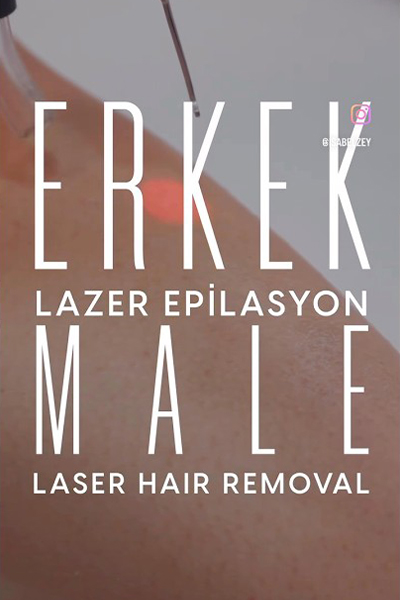 Male Laser Hair Removal